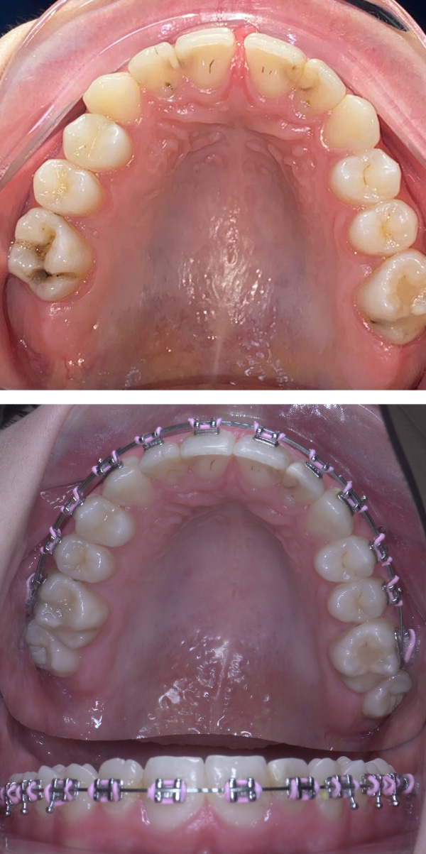 aparat dentar clinica stomatologica bucuresti