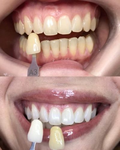 clinica-albire-dentara-bucuresti