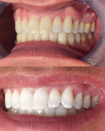 clinica-stomatologica-albire-dentara