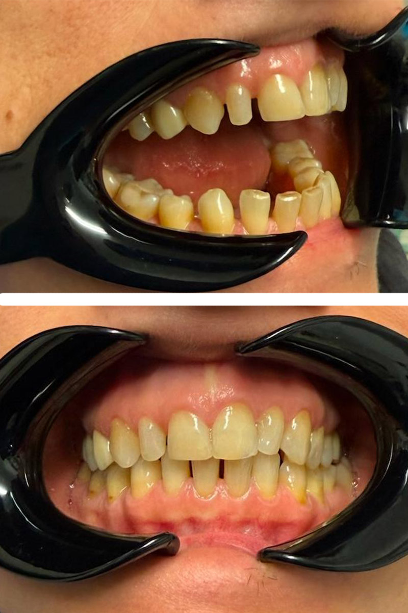 Before image