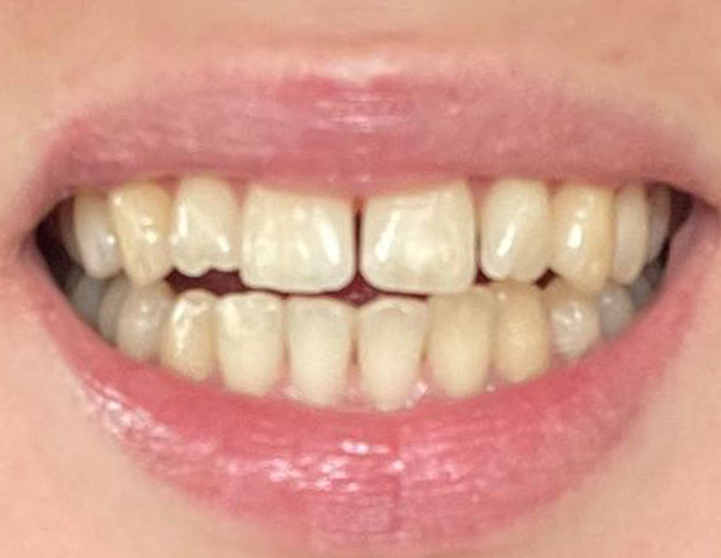 Before image