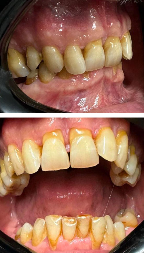 Before image