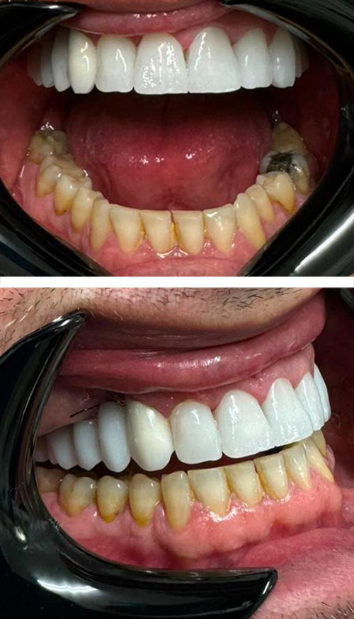 Before image