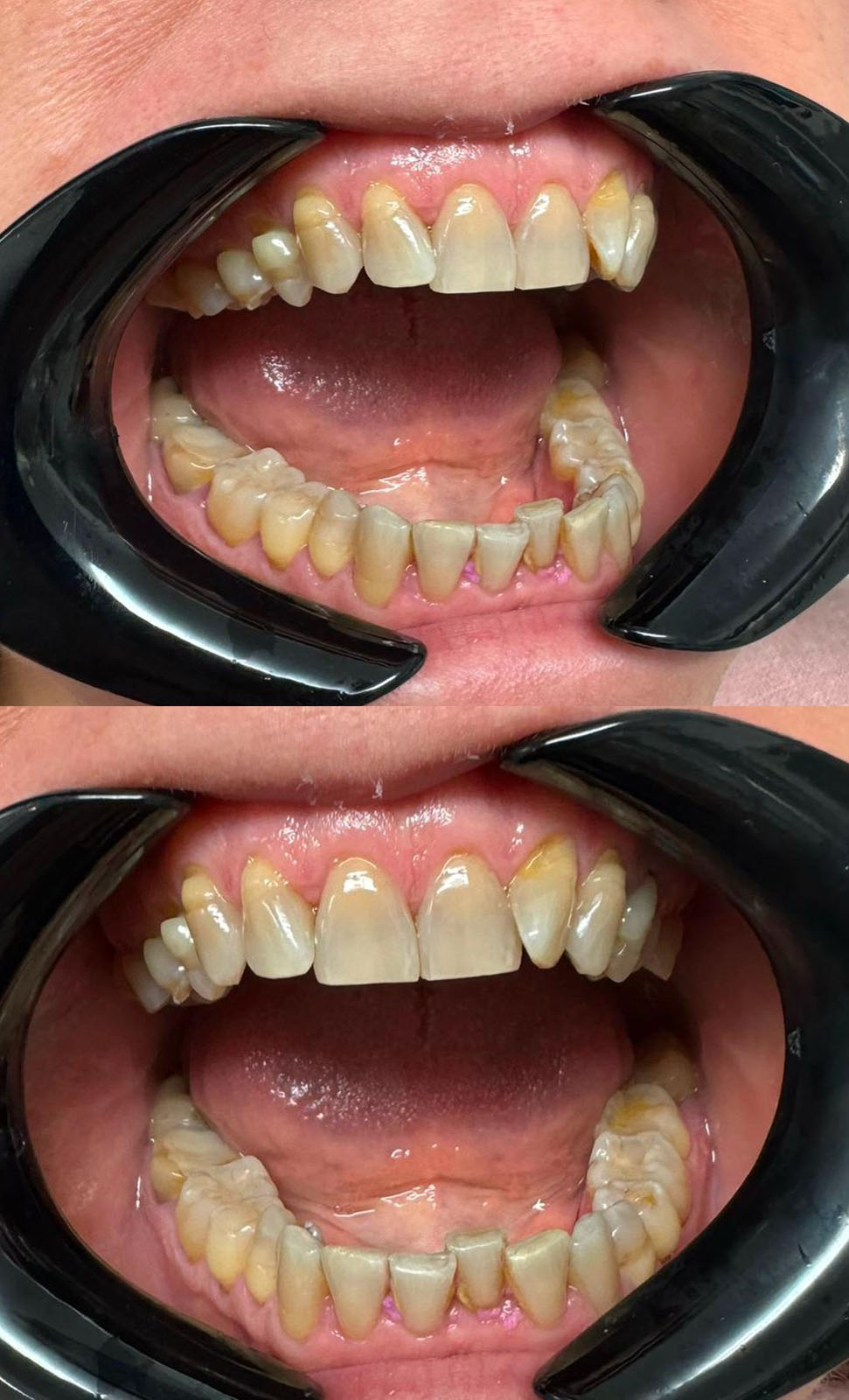 Before image