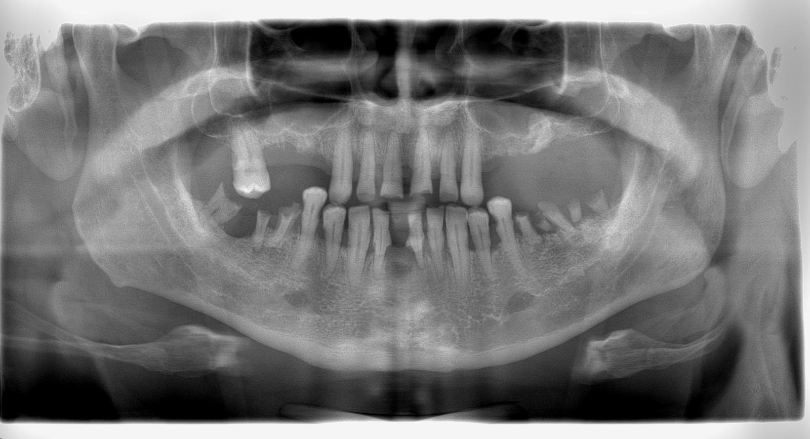 Before image