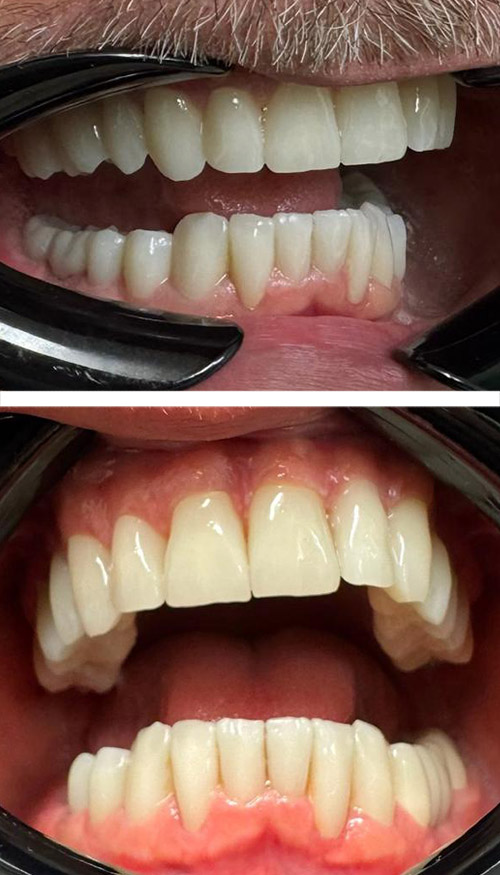 After image