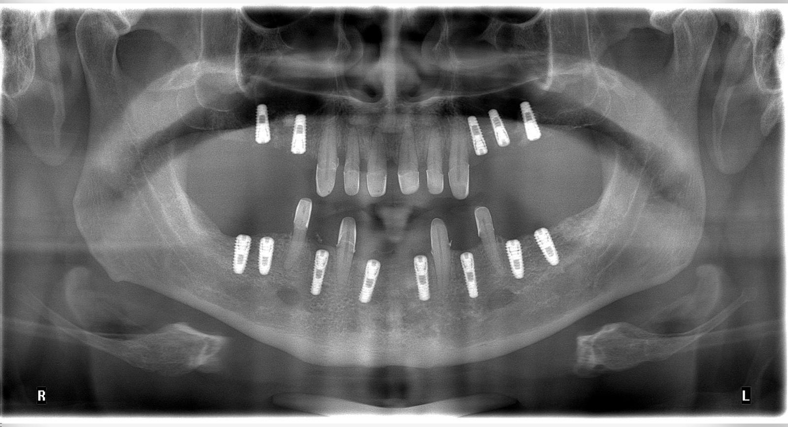 After image