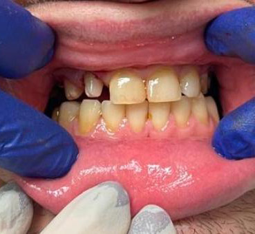 Before image
