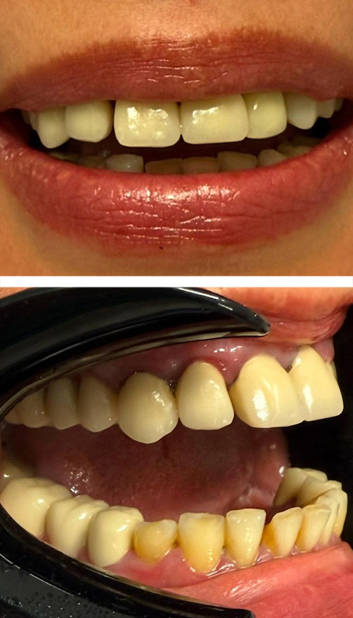 Before image