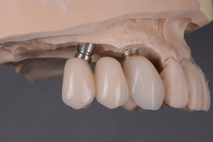 aditie-osoasa-clinica-dentara-bucuresti