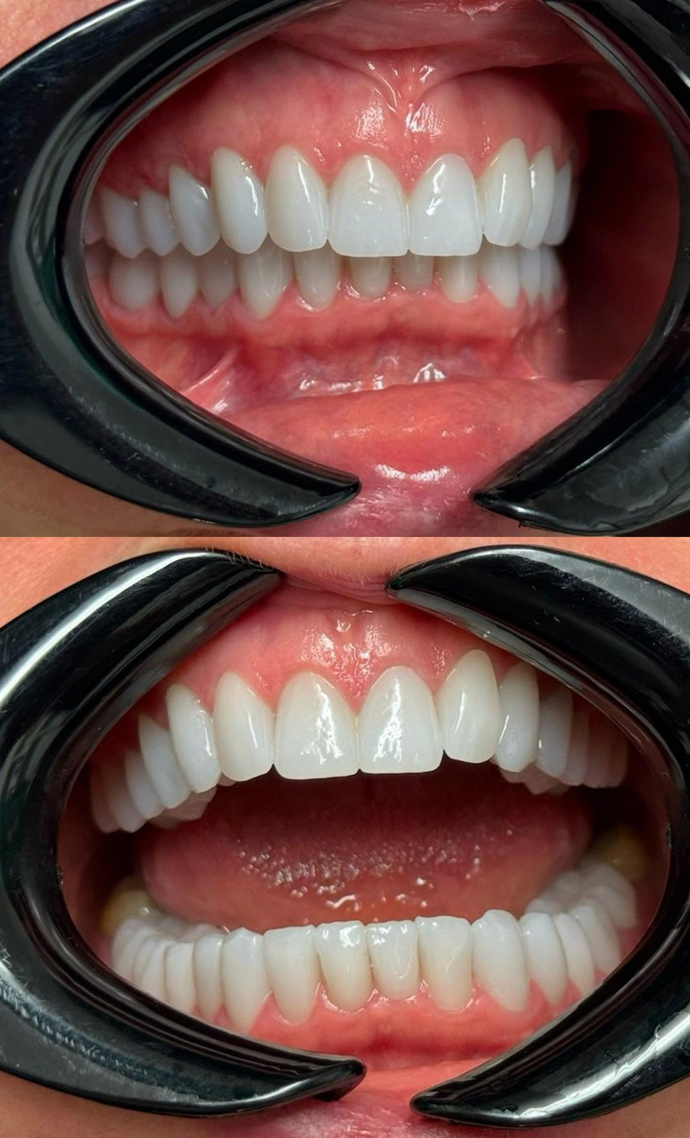 After image