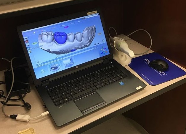 amprente digitale dentare