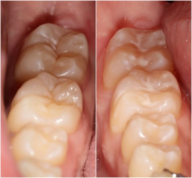 clinica-sigilare-dentara-bucuresti