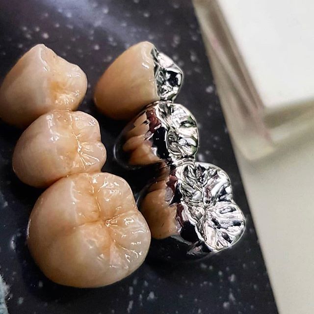 coronite metalo-ceramice