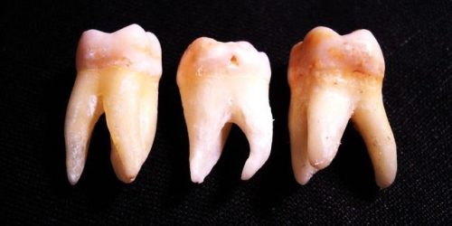 maseaua de minte sau molar de minte