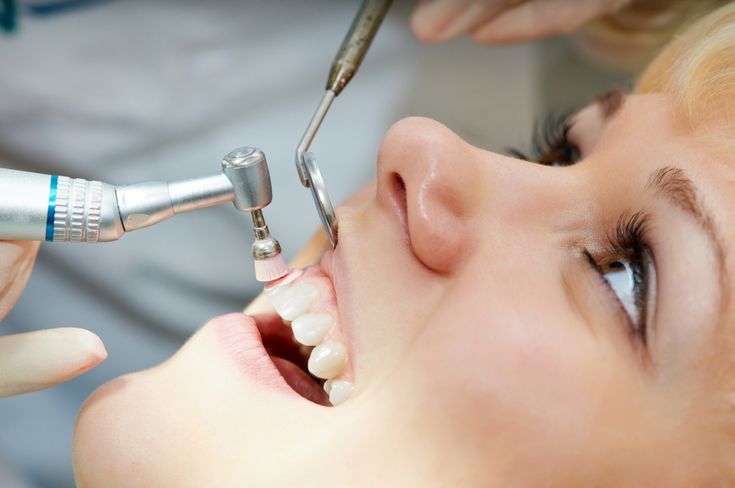 periaj profesional - clinica dentara Bucuresti HT Smile