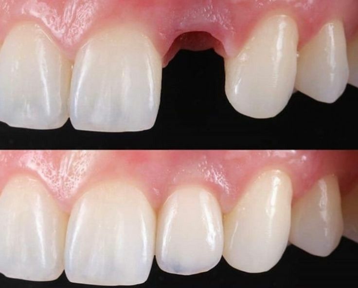 punte dentara stomatologie