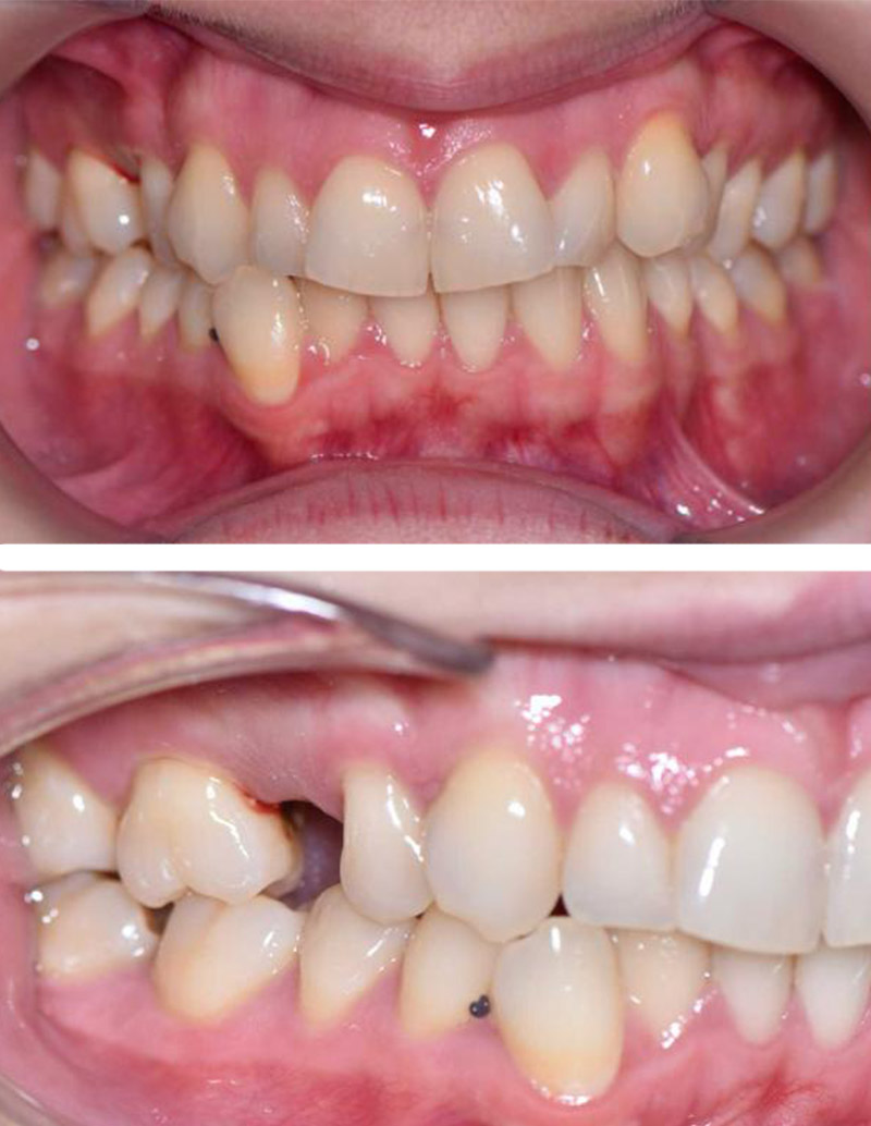Before image
