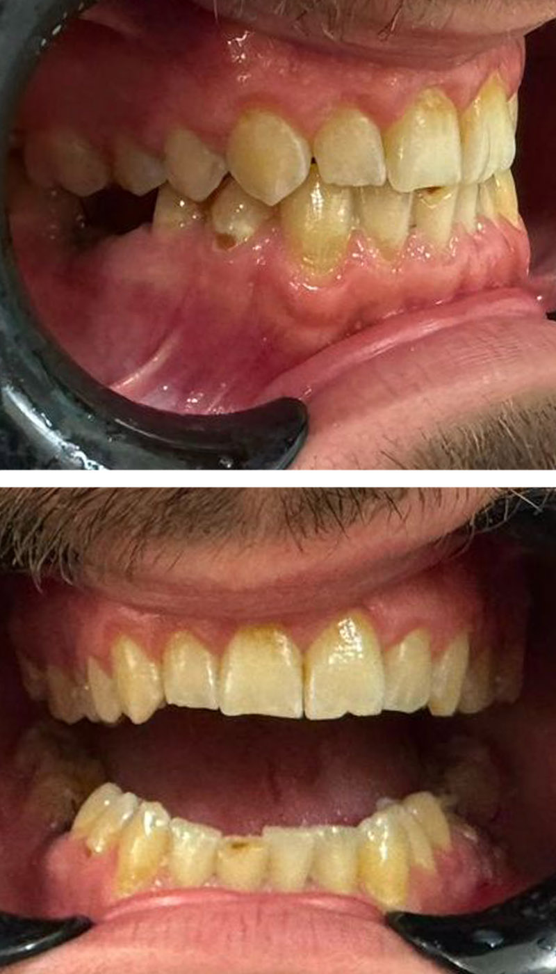 Before image