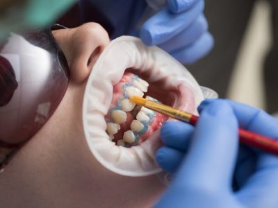 tratament-dentar-parodontologie