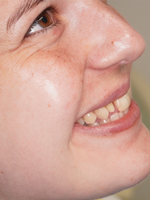 Before image