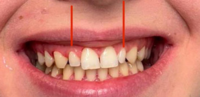Before image