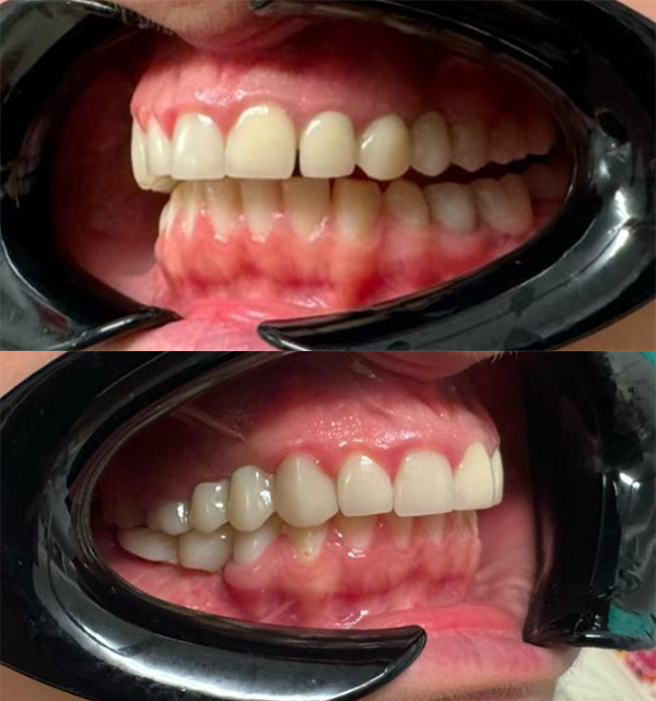 Before image