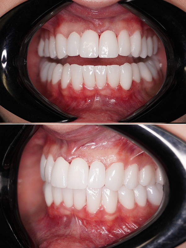 After image
