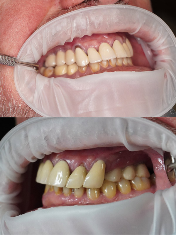 Before image