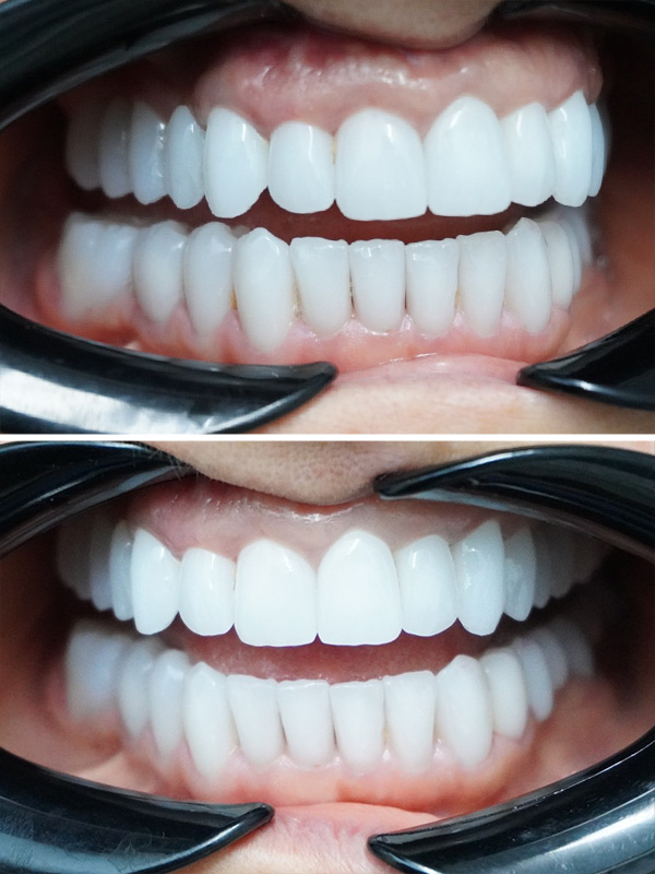 reabilitare-totala-orala-dentist-stomatolog-after1