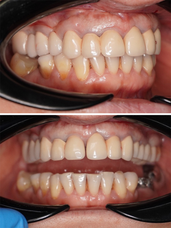 reabilitare-totala-orala-dentist-stomatolog-before1