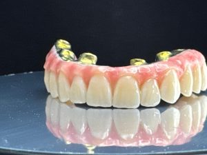 Calitate superioara lucrare ALL ON