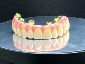 Implant ALL ON