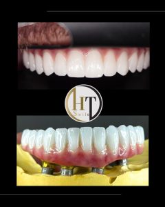 Lucrare finala zirconiu