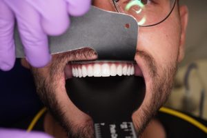 Materiale fizionomice si estetica superioara