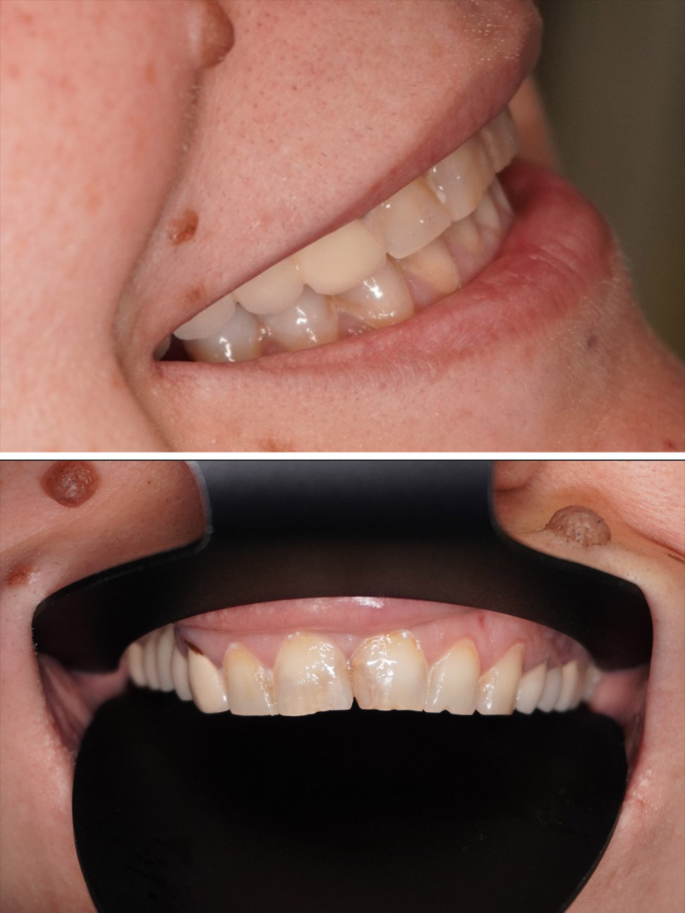 Before image