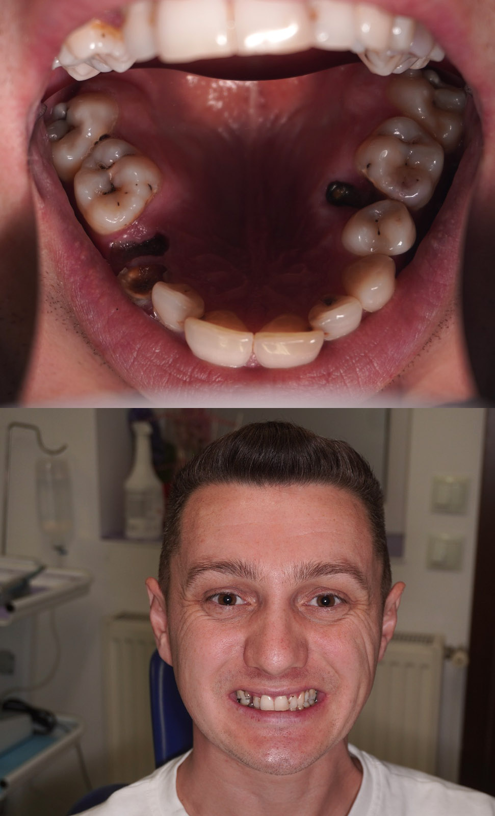 Before image