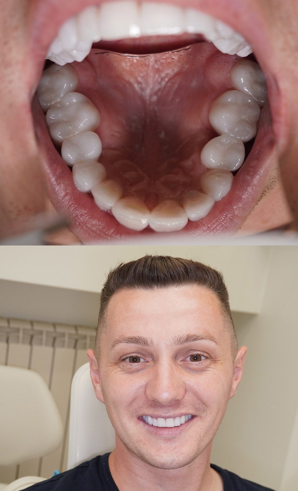 After image